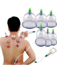 Buy Massage cups for joints 'PULL OUT A VACUUM APPARATUS', 6pcs  | Online Pharmacy | https://buy-pharm.com
